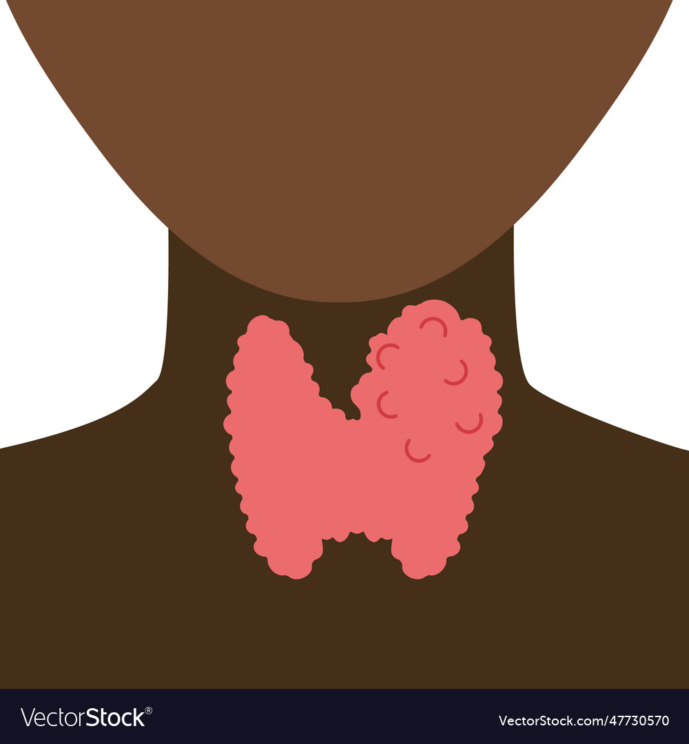 Enlarged Thyroid Gland On Black Neck Silhouette Vector Image