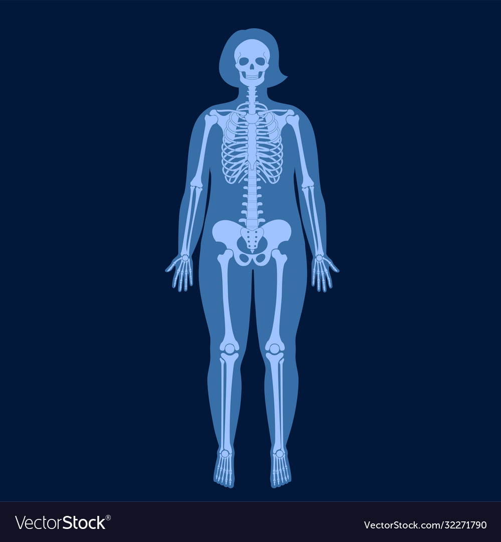 Skeleton X Ray Royalty Free Vector Image Vectorstock