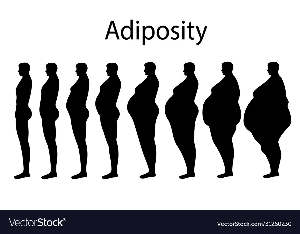 Male Obesity Royalty Free Vector Image Vectorstock