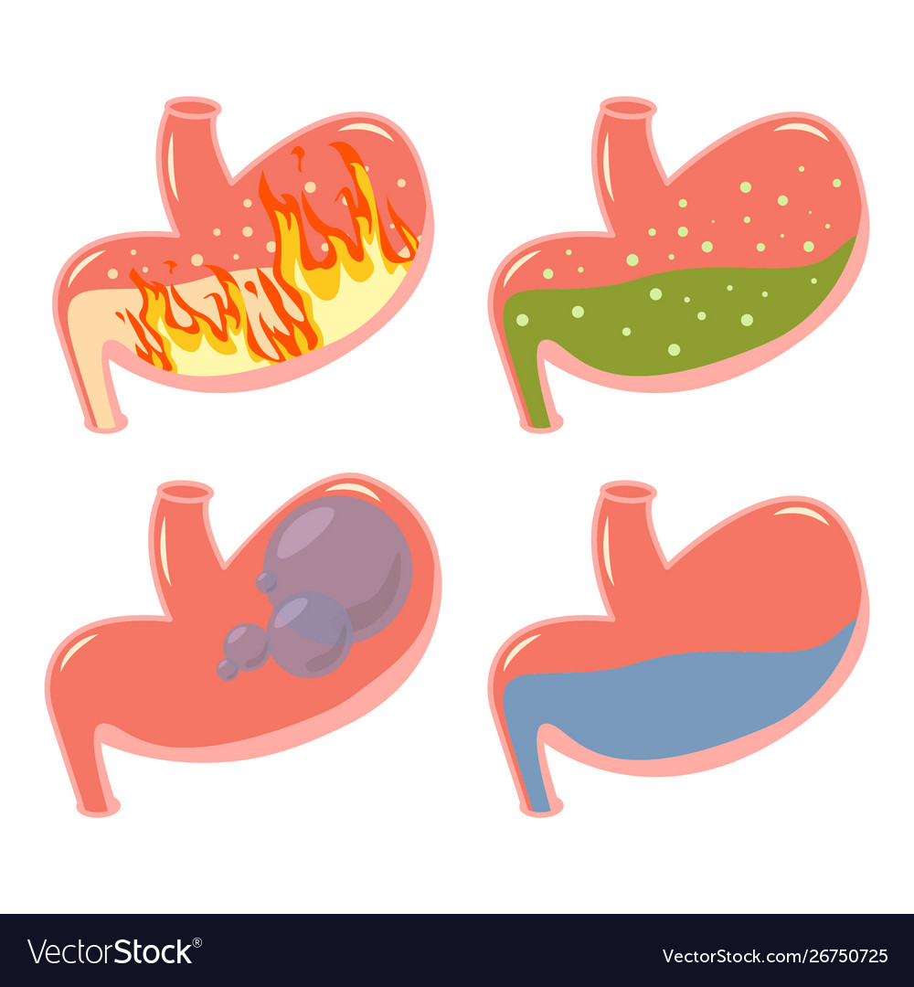 Pyrosis stomach medical set fire disorder Vector Image