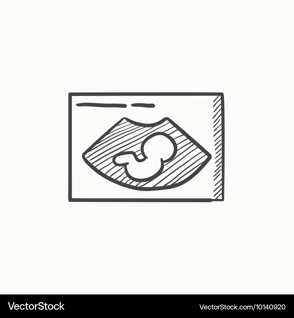 Fetal ultrasound sketch icon Royalty Free Vector Image