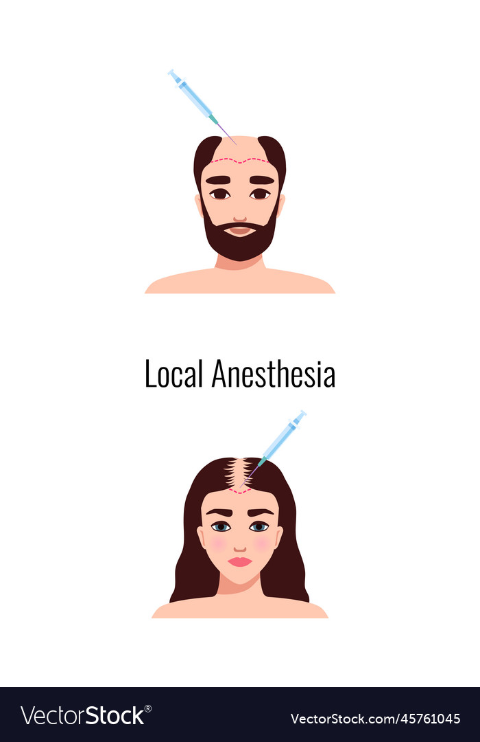 Alopecia local anesthesia composition Royalty Free Vector