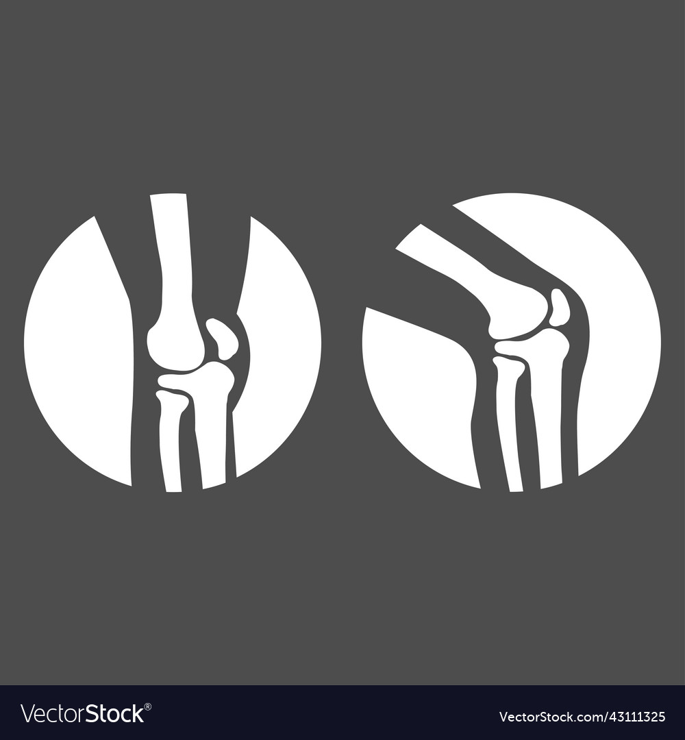 Human knee joint side view Royalty Free Vector Image