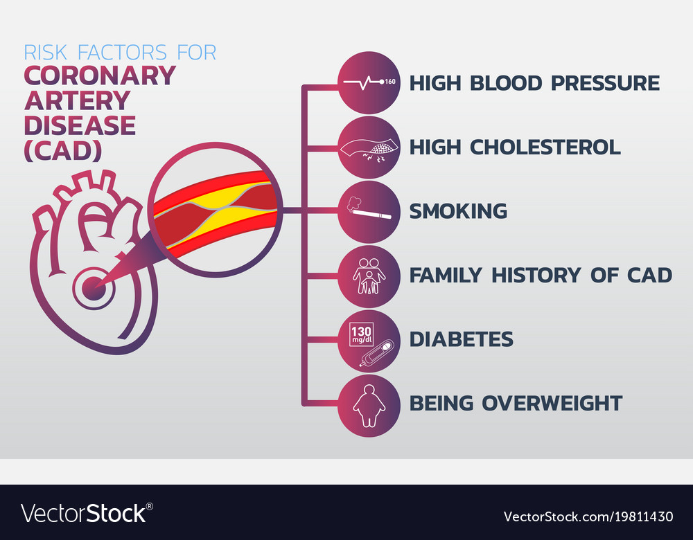Ischemic Heart Disease Ischemic Cardiomyopathy Vector Image