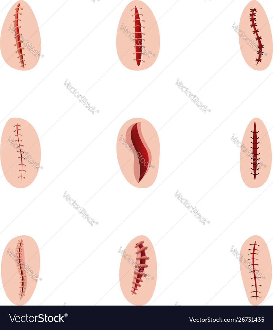 surgical suture