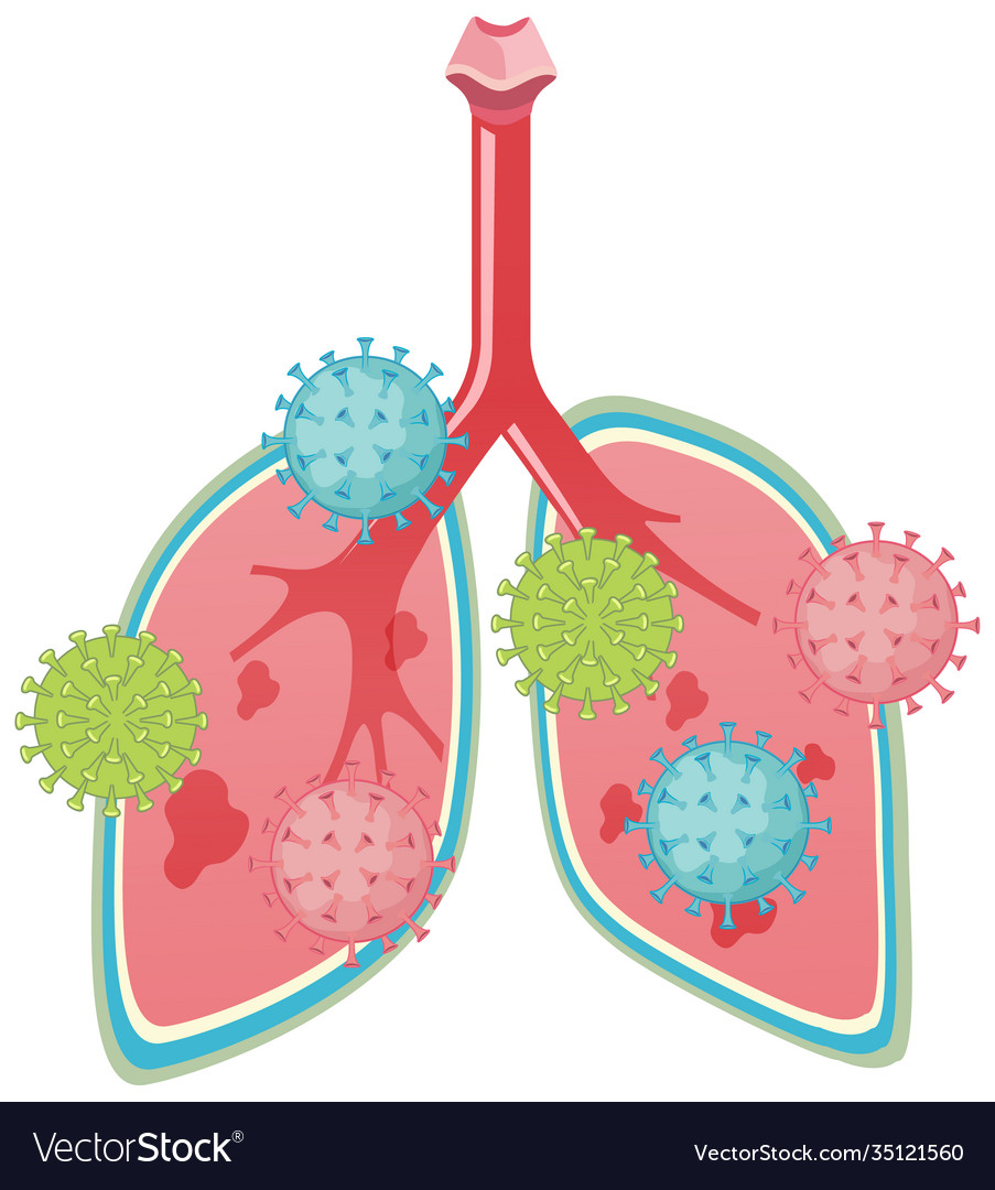 Lungs attacked coronavirus cartoon style Vector Image