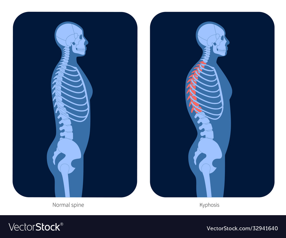 Spine x ray Royalty Free Vector Image - VectorStock