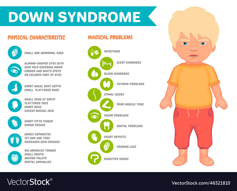 Symptoms Of Down Syndrome Vector Infographic Poster Stock Vector Image