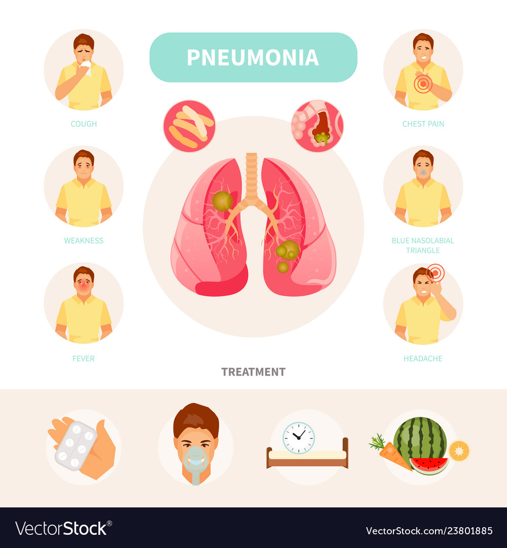 Pneumonia infographic Royalty Free Vector Image