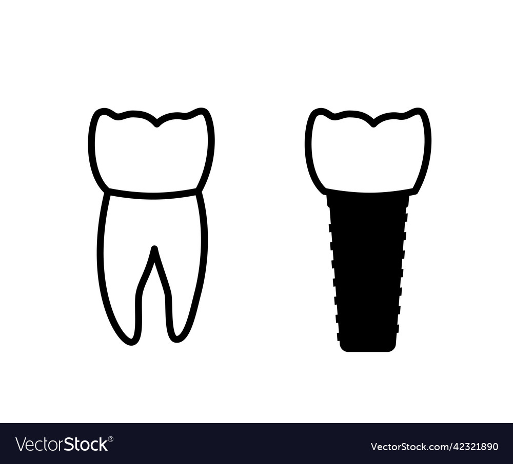 Dental implant procedure Royalty Free Vector Image