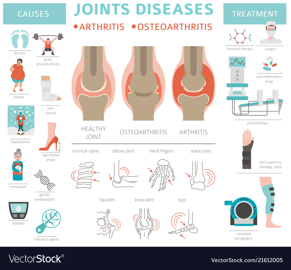 Joints diseases arthritis osteoarthritis symptoms Vector Image