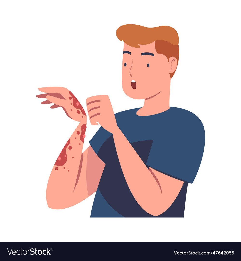 Man character with skin problem suffering Vector Image