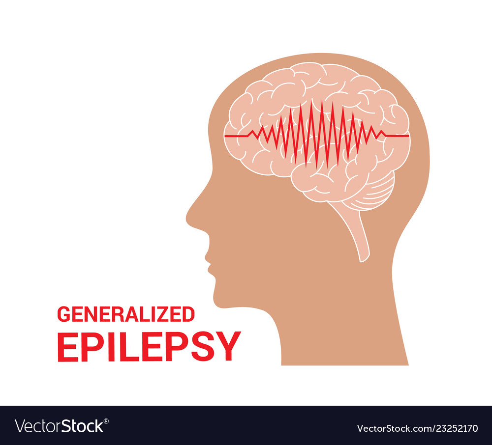 Epilepsy icon Royalty Free Vector Image - VectorStock