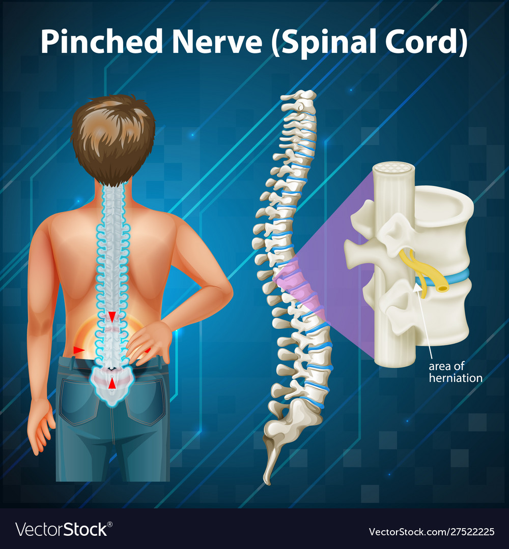 Diagram showing spinal cord