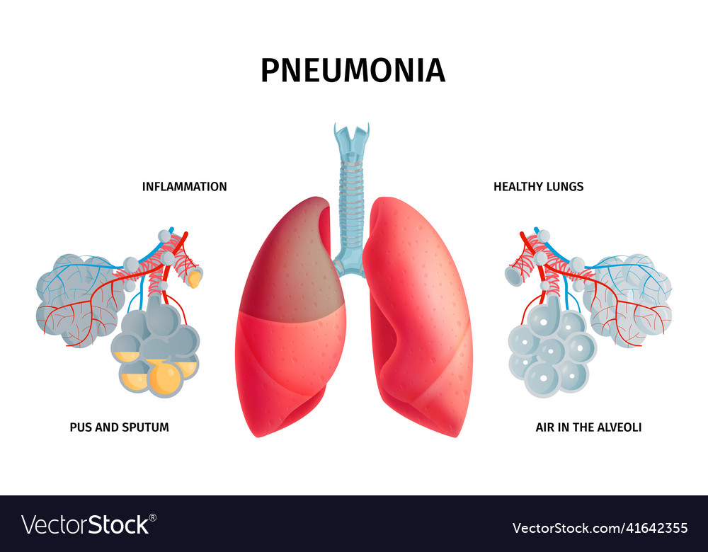 Human lung anatomy infochart Royalty Free Vector Image