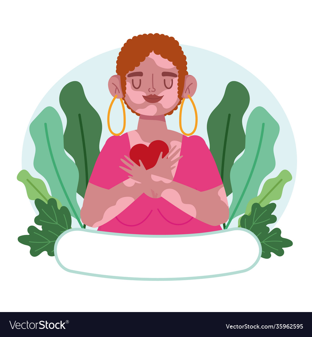 Portrait woman with vitiligo cartoon character Vector Image