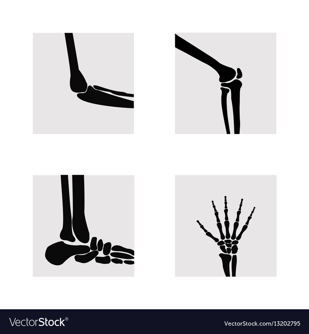 Medical orthopedic of set