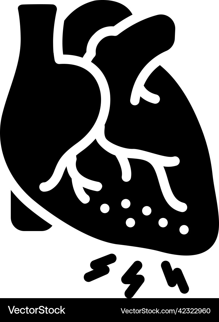 Cholesterol Royalty Free Vector Image - VectorStock