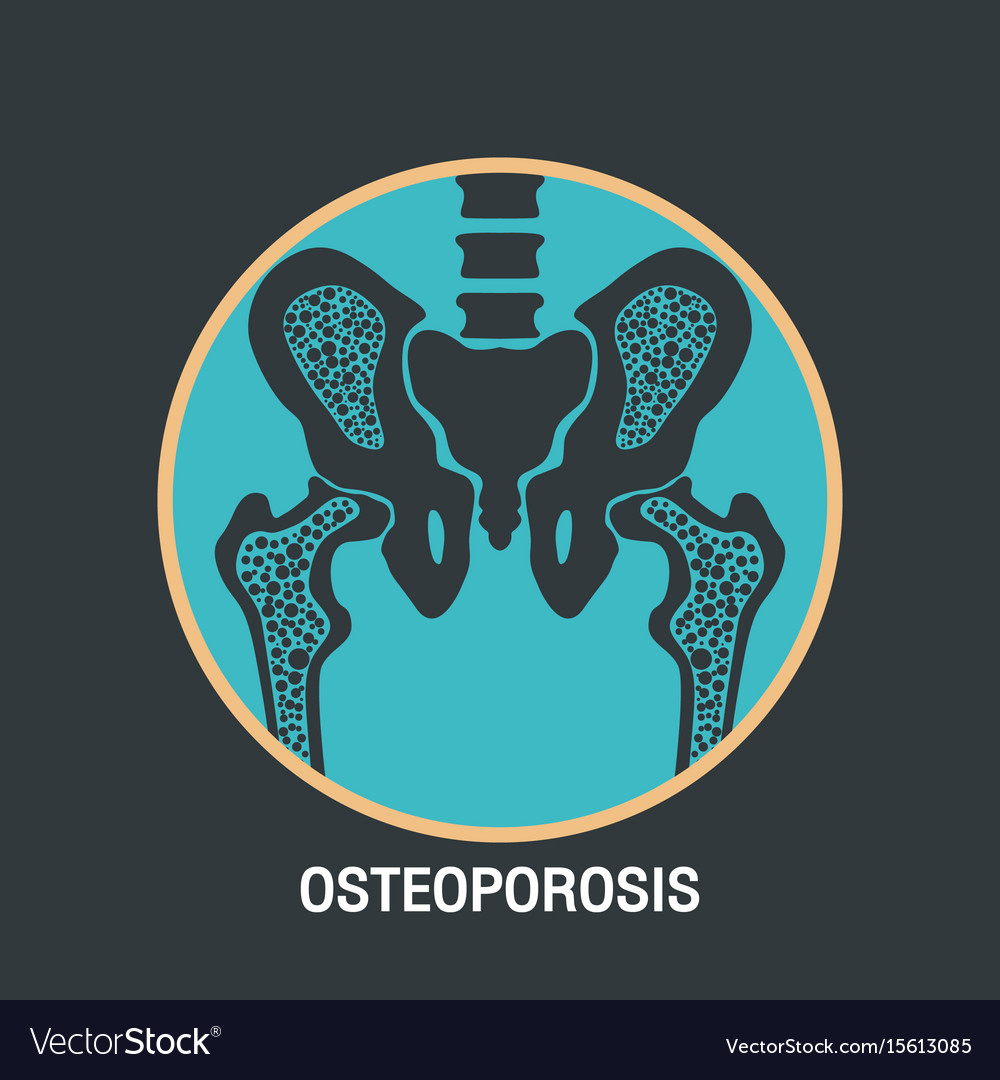 Osteoporosis logo icon design Royalty Free Vector Image