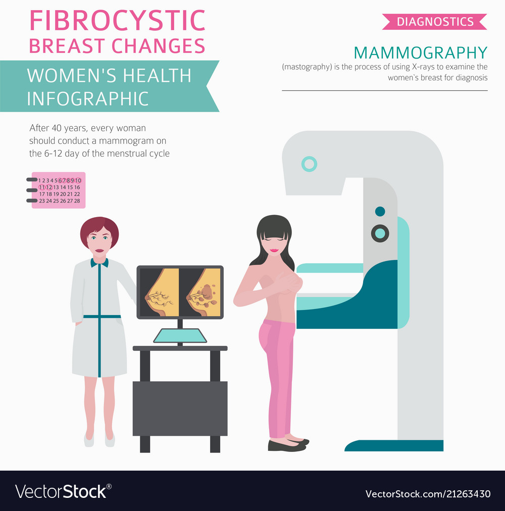 fibrocystic breast changes brown dishcharg