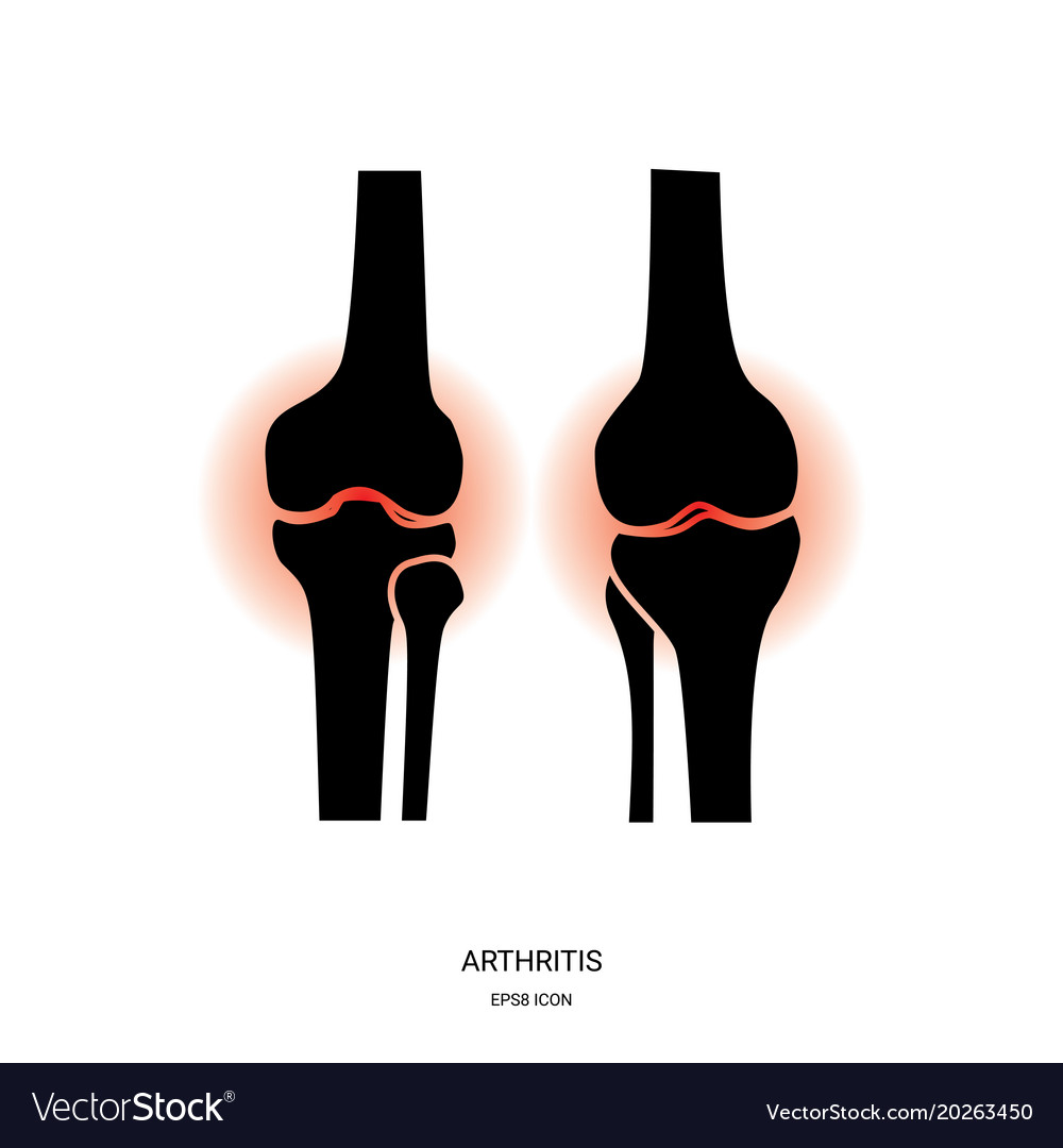 Arthritis and knee joint icon Royalty Free Vector Image