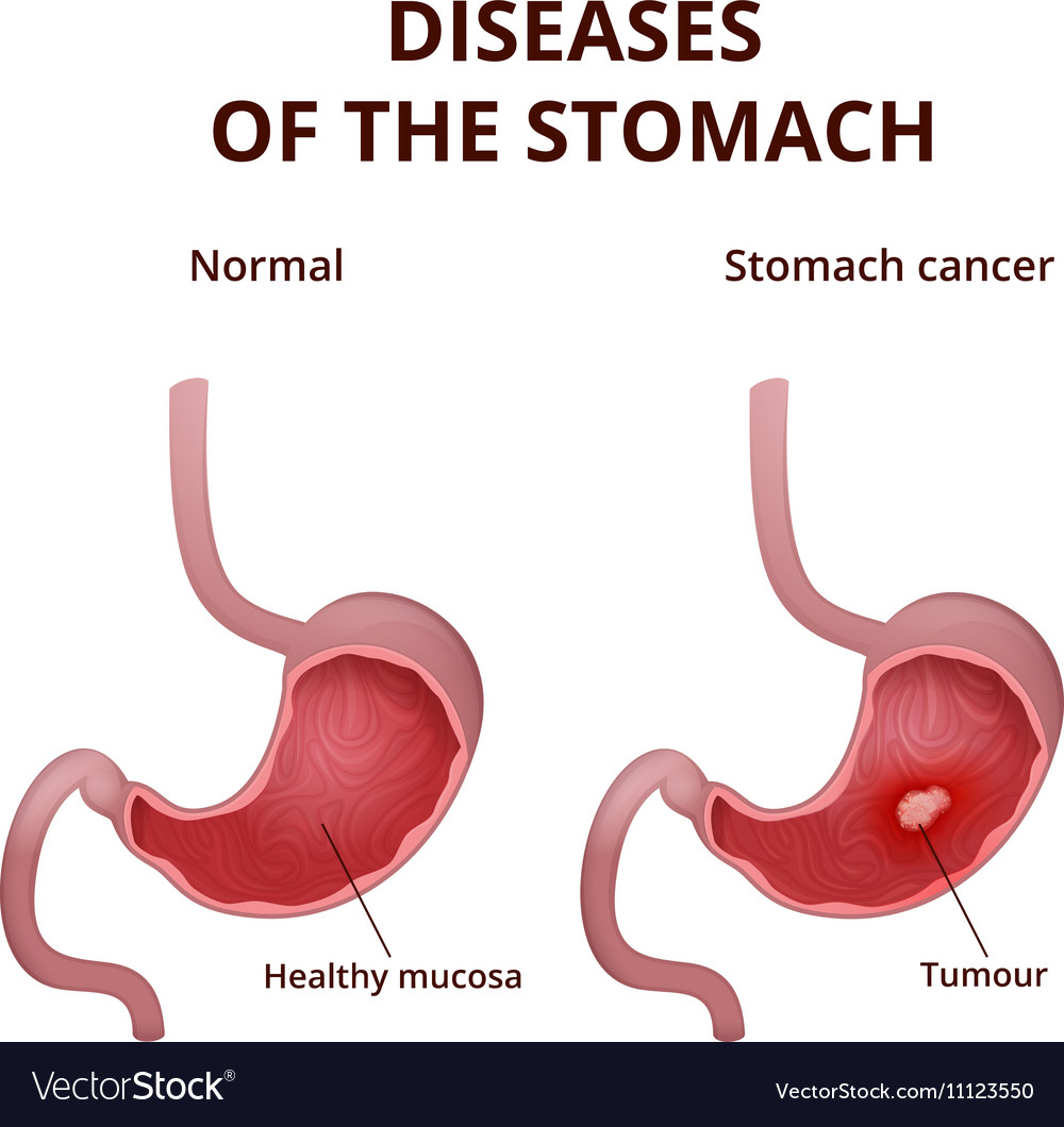 Anatomy human stomach Royalty Free Vector Image