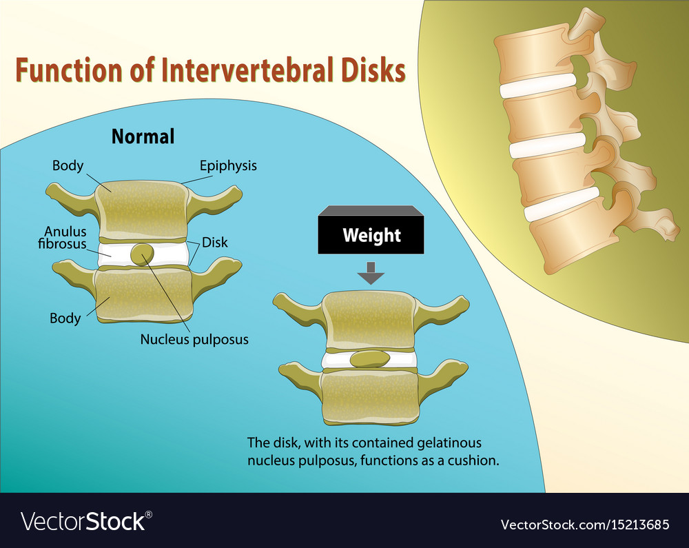 Disks