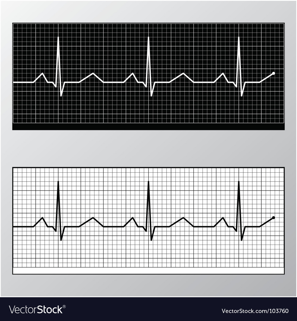 Heart pulse monitor