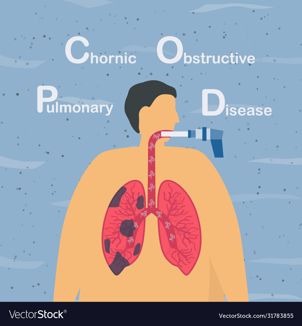 Spirometry is a test used to measure lung Vector Image