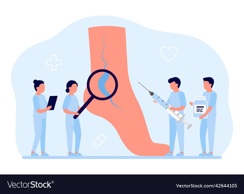 Varicose and vein thrombosis treatment leg tiny