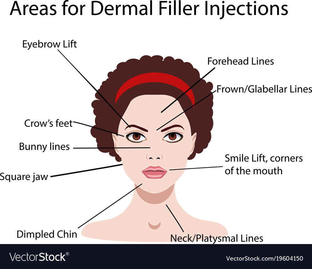 Areas for rejuvenation cosmetological injections Vector Image