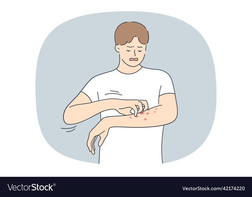 Unhappy Man Suffer From Allergy Or Psoriasis Vector Image