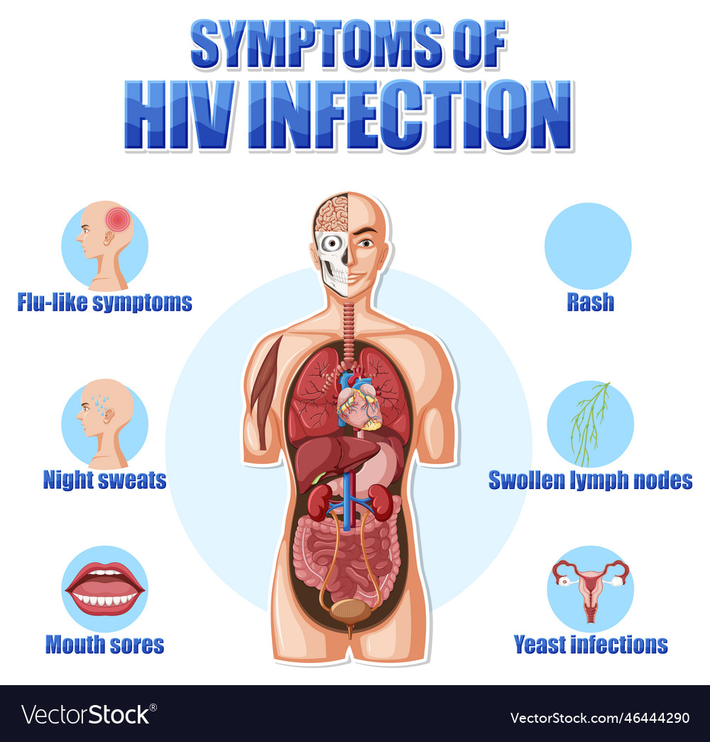 Informative poster of main symptoms of hiv Vector Image