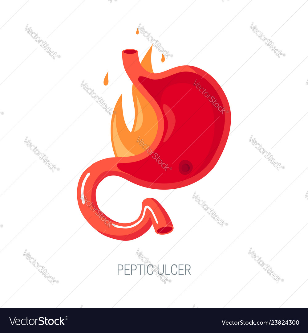 Peptic ulcer concept in flat style icon