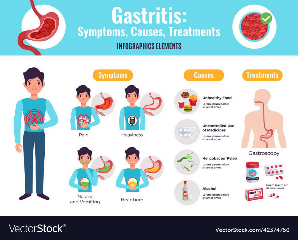 Gastritis symptoms causes treatments Royalty Free Vector