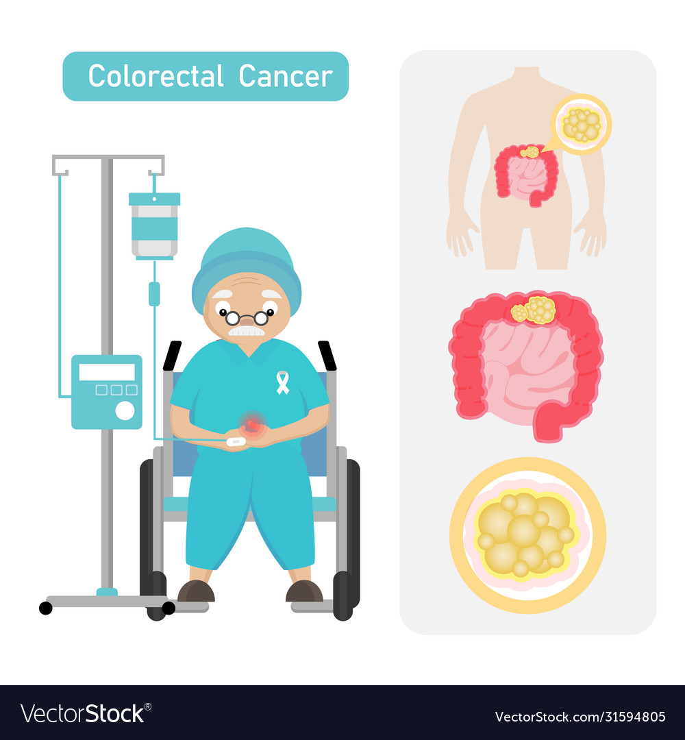 Senior man patient with coloreactal cancer