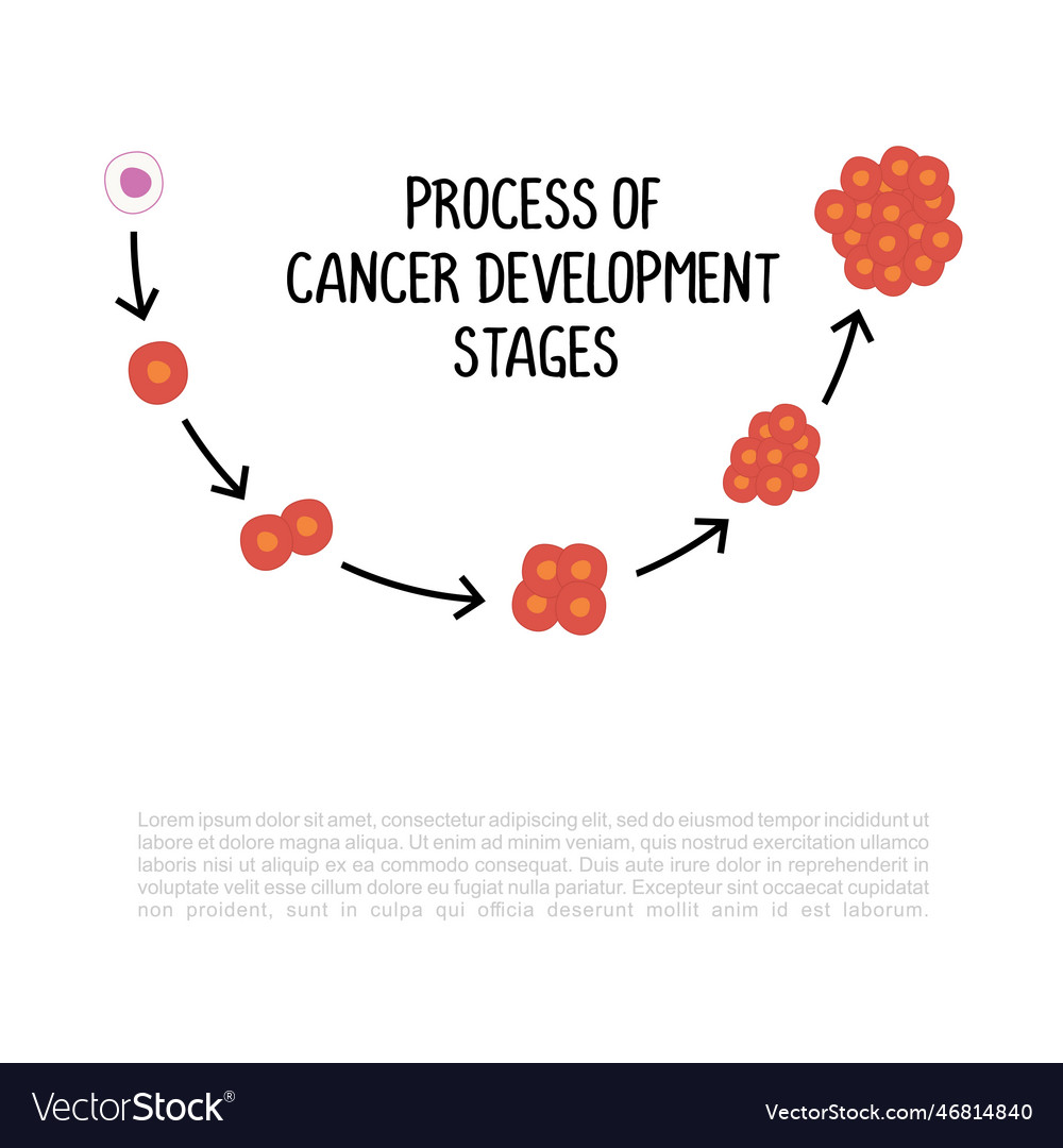 Process of cancer development stages isolated Vector Image