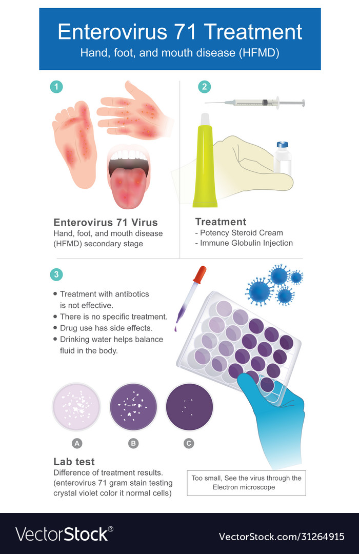 Enterovirus 71 treatment explain skin