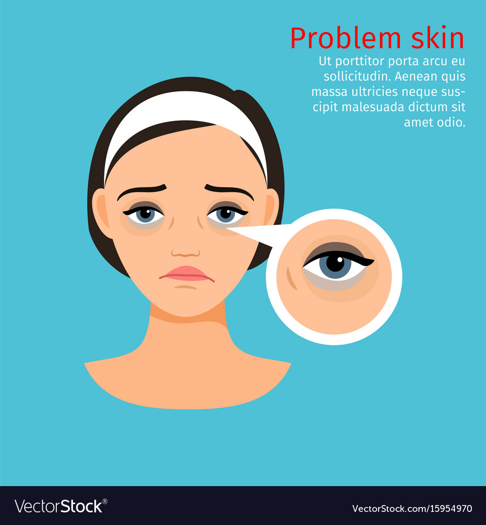 Woman face problem eye black circles