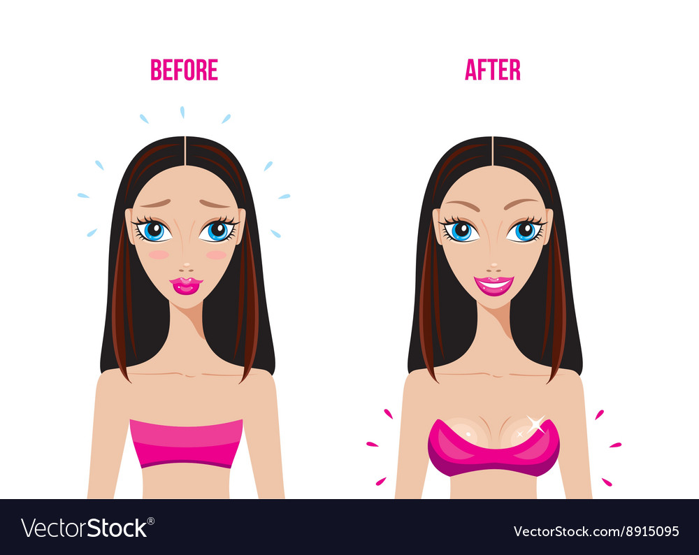 Before and after breast augmentation concept, woman with very • adesivos  para a parede forma, feminino, beleza