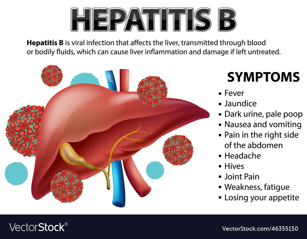 Symptoms of hepatistis b Royalty Free Vector Image