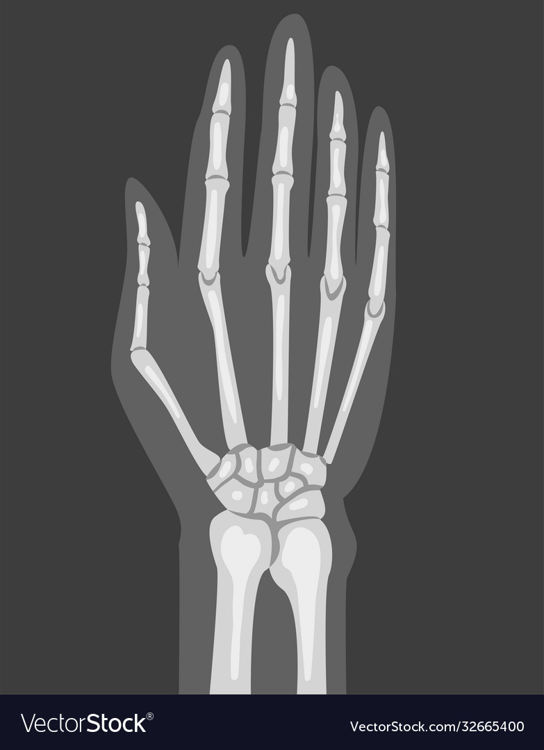 X-ray film hand image vector image X-ray film hand image