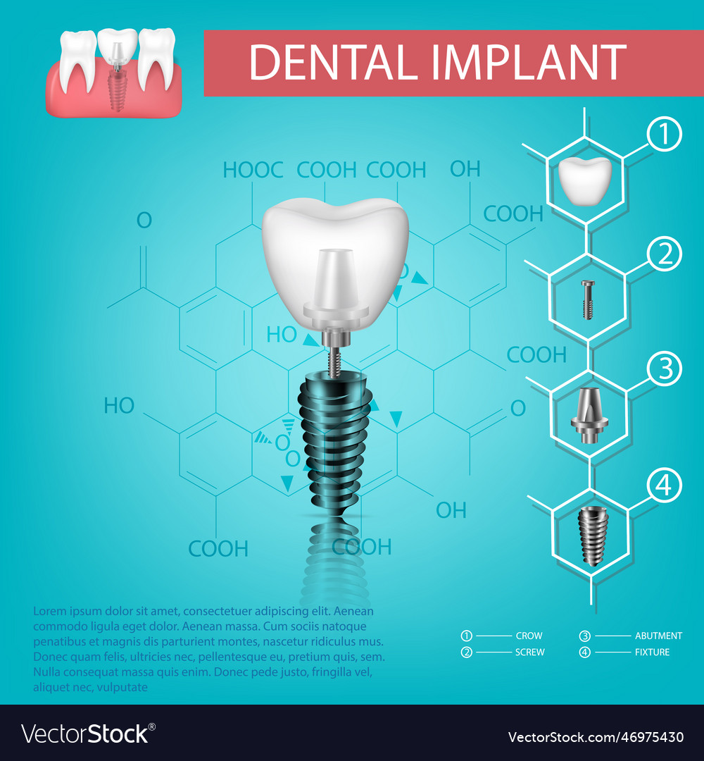 Realistic tooth structural elements of a dental