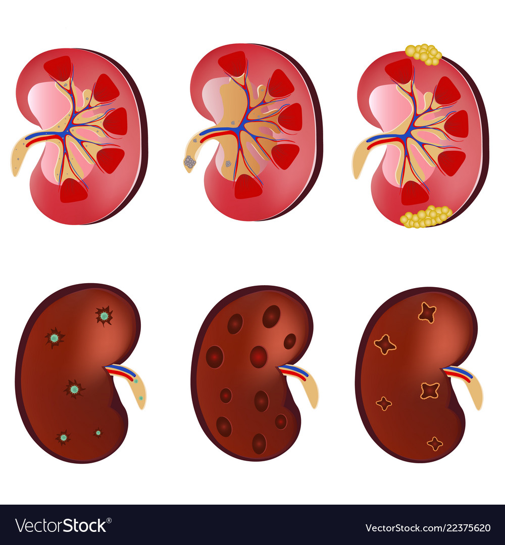 3d realistic anatomy set kidney normal Royalty Free Vector