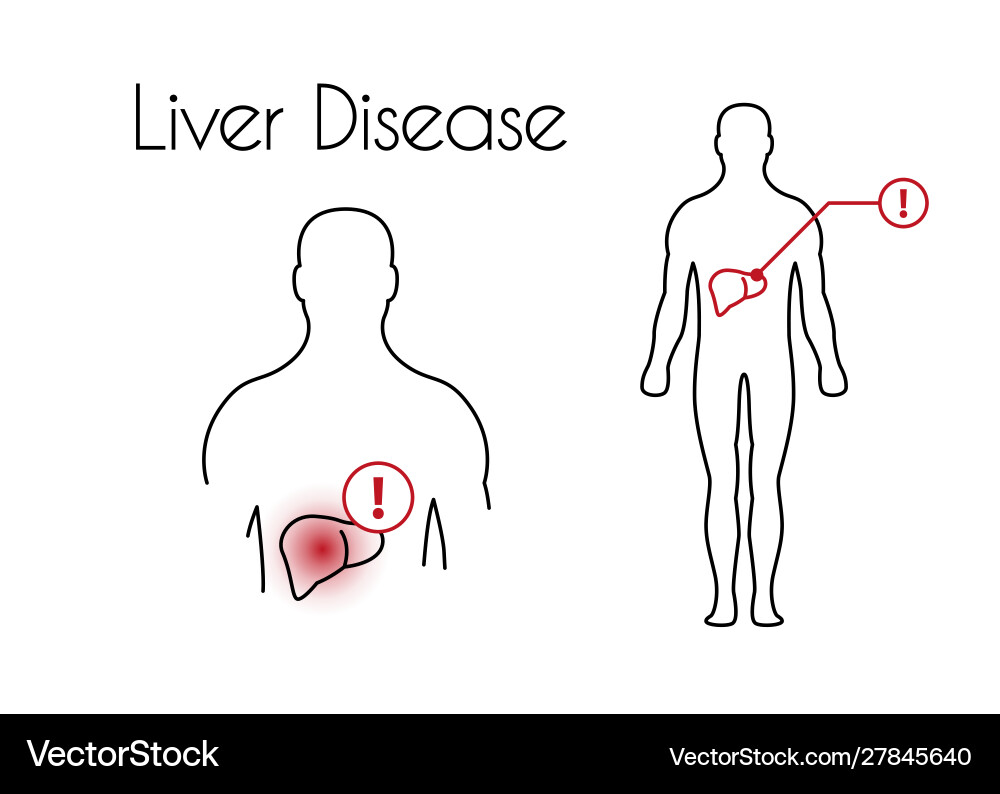 Liver disease linear icon young man Royalty Free Vector