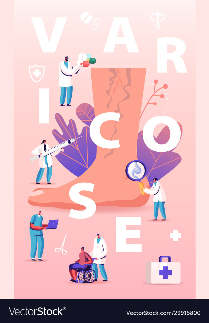 Varicose treatment concept tiny doctor characters vector image Varicose treatment concept tiny doctor characters