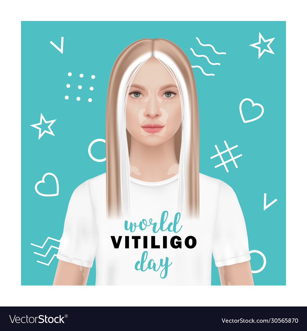 World vitiligo day a woman vector image World vitiligo day a woman