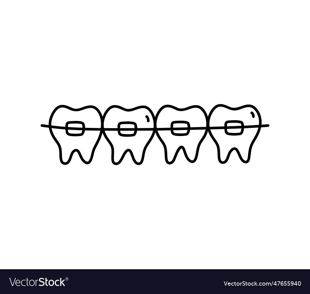 Braces on teeth isolated white background