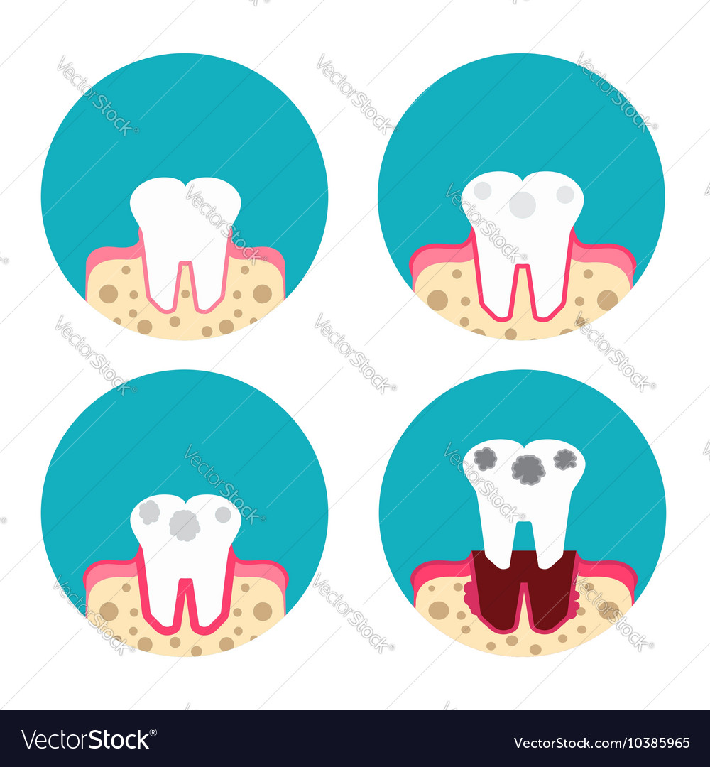 Periodontal disease icons set