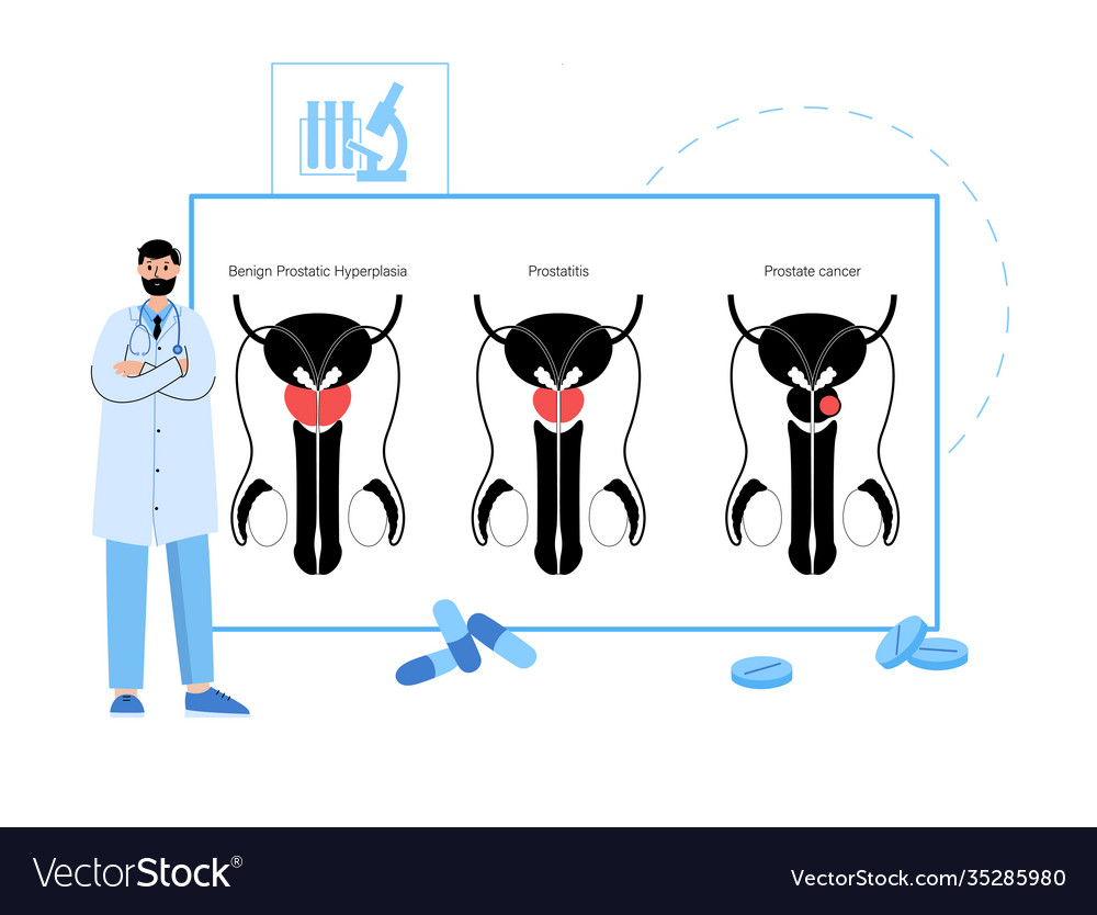 Man reproducive system problems vector image Man reproducive system problems